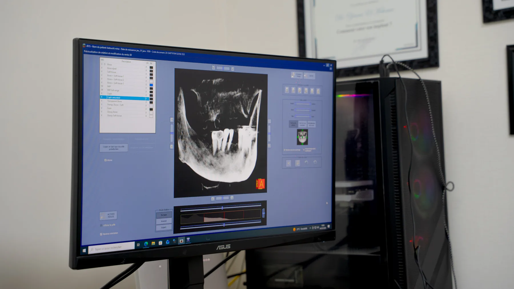 Imagerie CBCT